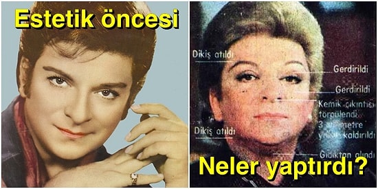 Zeki Müren'in Ölüm Korkusu Yaşadığı Zorlu Estetik Ameliyatının Bilinmeyen Detayları