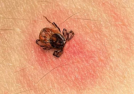 Lyme Hastalığı Nedir, Belirtileri Nelerdir? Tanı ve Tedavisi Nasıl Yapılır?