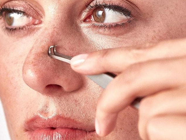 2. Siyah noktalar sebum ve ölü deri hücreleriyle tıkanmış foliküllerdir. Tıkanıklık yüzeydeyse siyah nokta oluşur. Siyah noktanın resmi ismi açık komedondur.