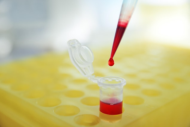 WBC Nedir?