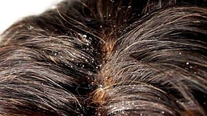 Xetofjyexonkym Xetofjyexonkym