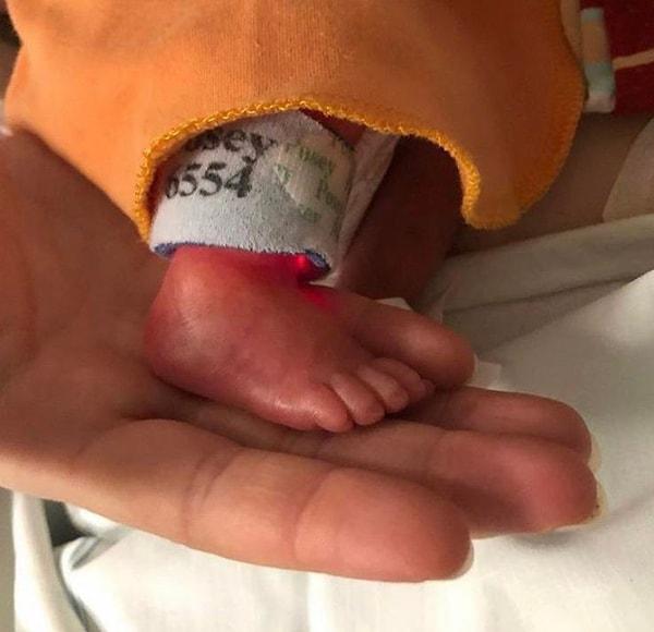 2. Yenidoğan bir bebeğe göre oldukça büyük ayak parmağı olan bu bebek.