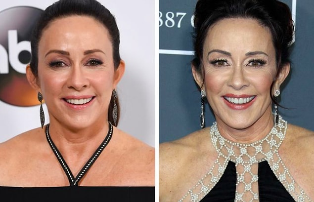11. Patricia Heaton