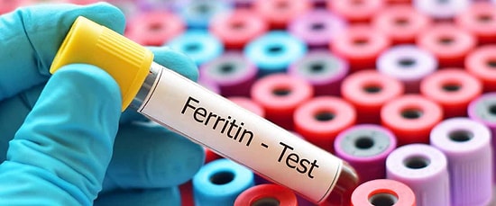 Ferritin Nedir? Yüksekliği ve Düşüklüğü Ne Anlama Gelmektedir? Değerleri Kaç Olmalıdır?