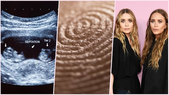 DNA Dizilimleri Aynı Olan Tek Yumurta İkizlerinin Parmak İzleri Neden Farklı?