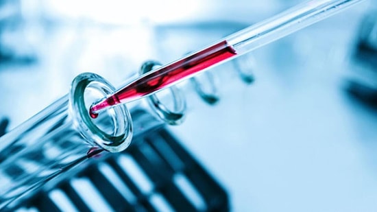 HCT: Hematokrit Nedir? Yüksekliği ve Düşüklüğü Ne Anlama Gelir? Değerleri Kaç Olmalıdır?