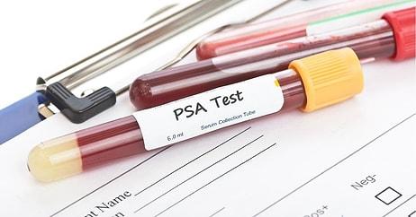 PSA: Prostat Spesifik Antijen Nedir? Yüksekliği ve Düşüklüğü Ne Anlama Gelir? Değerleri Kaç Olmalıdır?