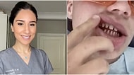 Dişlerini Törpülettikten Sonra Yaptırdıkları Kaplamaları Çeken TikTok Kullanıcılarına Uzmanlardan Tepki Geldi