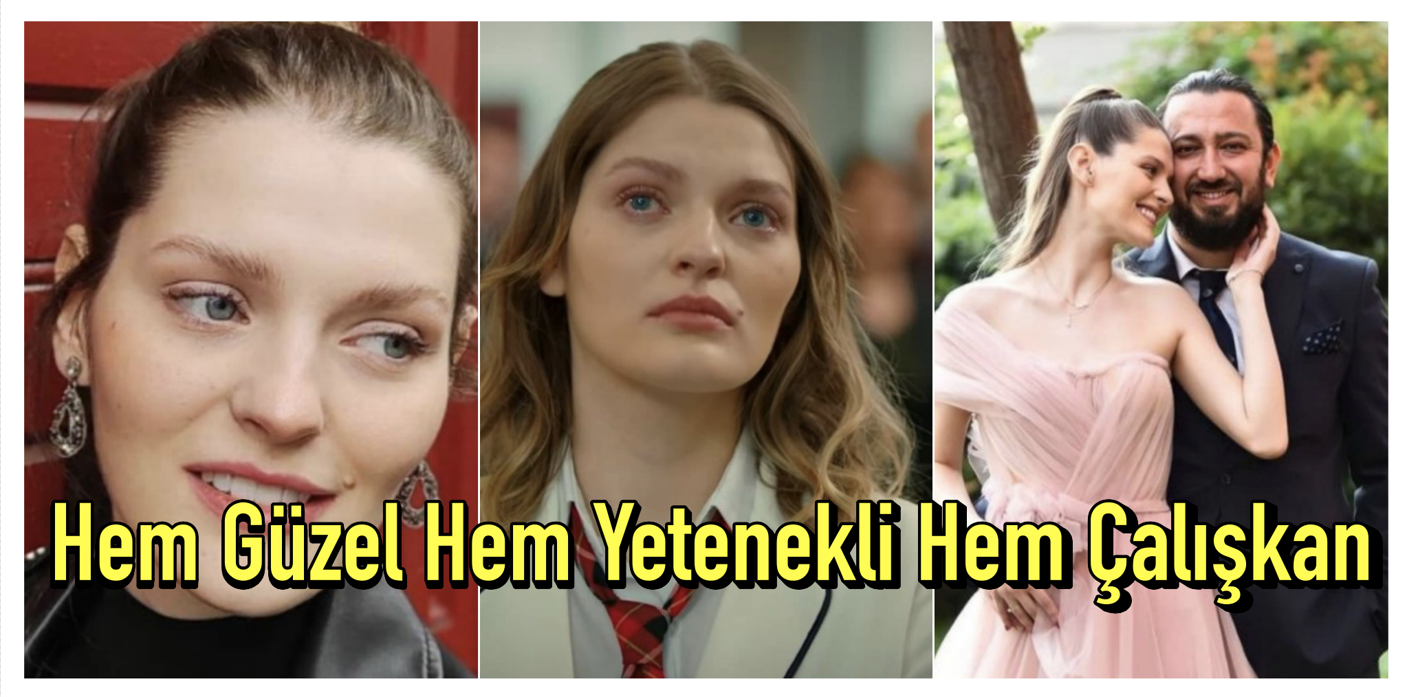 gözde türker estetiksiz hali