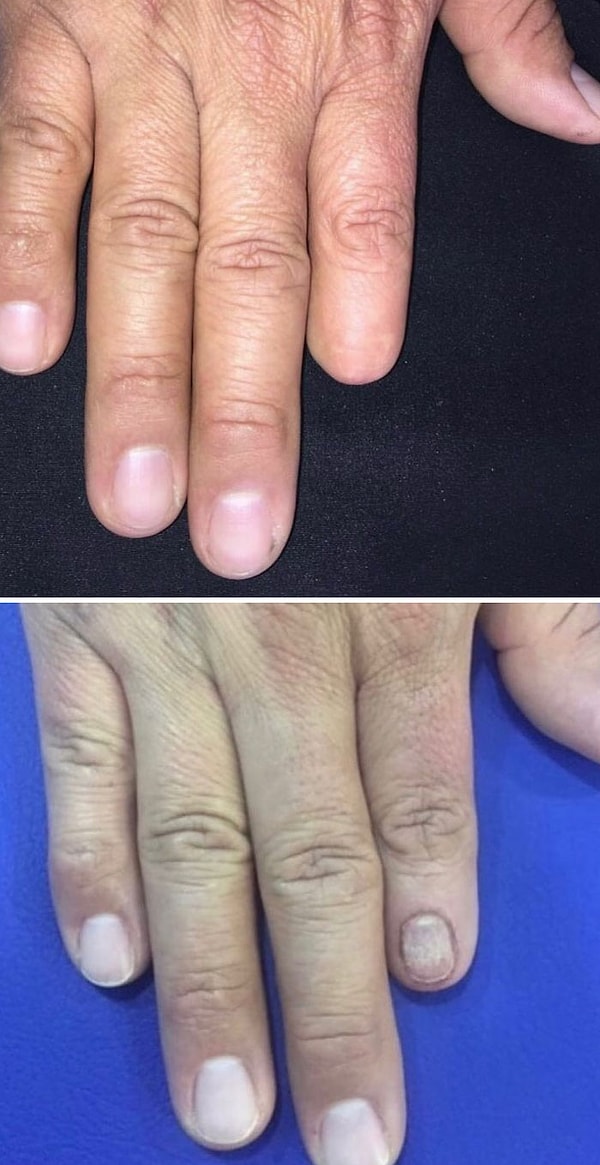 3. Маленькая деталь меняет многое