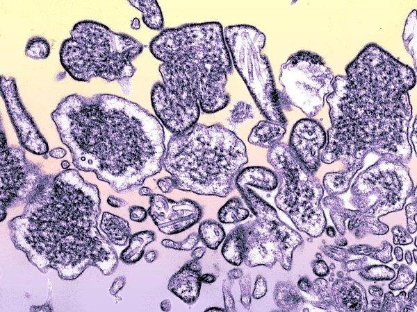Nipah virüsü enfeksiyonun ilk belirtileri spesifik olmadığından en başta tanı koyulduğu pek görülmüyor.