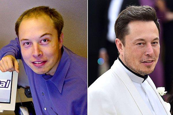 1. Tesla'nın kurucusu ünlü iş insanı Elon Musk'ın saç ektirme işlemine 20 bin dolar harcadığı tahmin ediliyor.