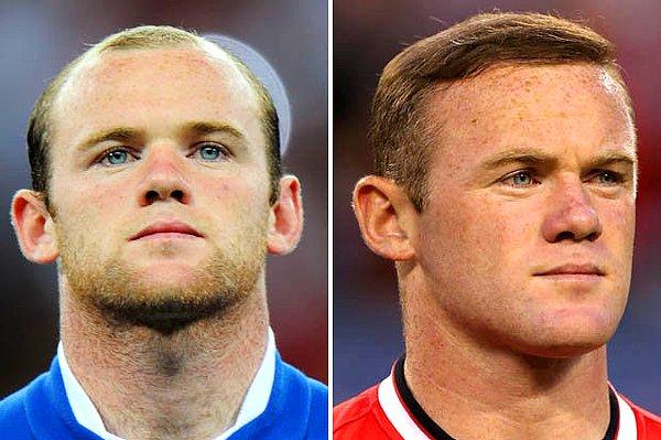 3. Liverpool doğumlu İngiliz futbolcu Wayne Rooney de saçlarına protez yaptırmış.
