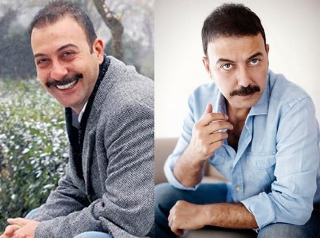 2. Ünlü oyuncu ve komedyen Hakan Yılmaz da saç ektiren isimlerden.