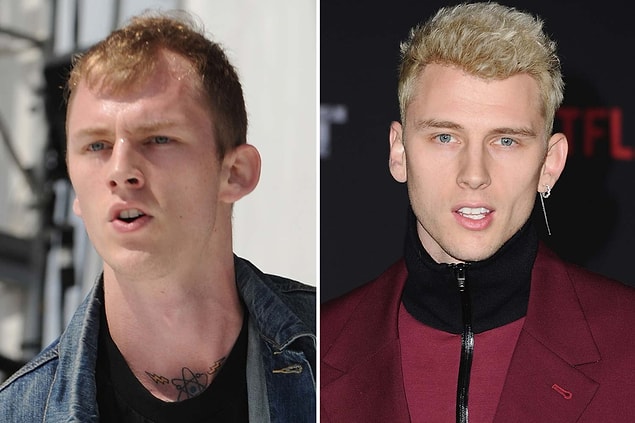 12. Megan Fox ile olan ilişkisiyle şu sıralar gündemden düşmeyen genç Rapçi Machine Gun Kelly de birkaç yıl önce saç ektirmiş.