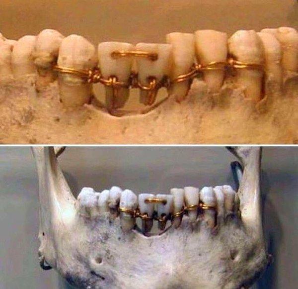 4. 4 bin yıllık bir mumyada rastlanan diş teli: