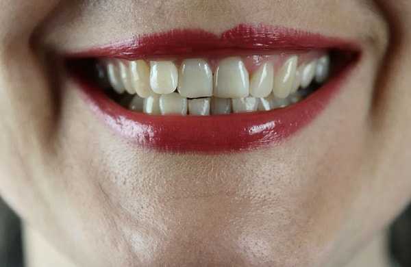 5. Новые зубы