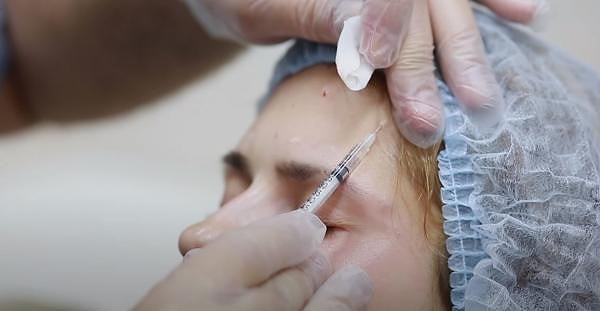 Нейротоксин, один из самых опасных известных науке, помогает уменьшить морщины, поскольку расслабляет мышцы лба.