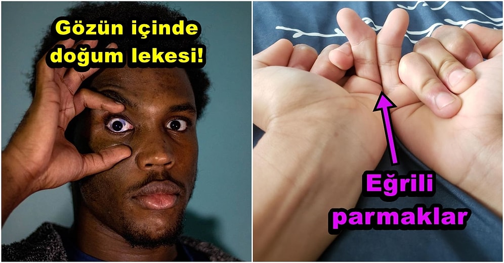 Vücutlarındaki Şaşırtıcı Eşsiz Özellikleriyle Dönüp Bir Daha Bakmanızı Sağlayacak 18 Kişi