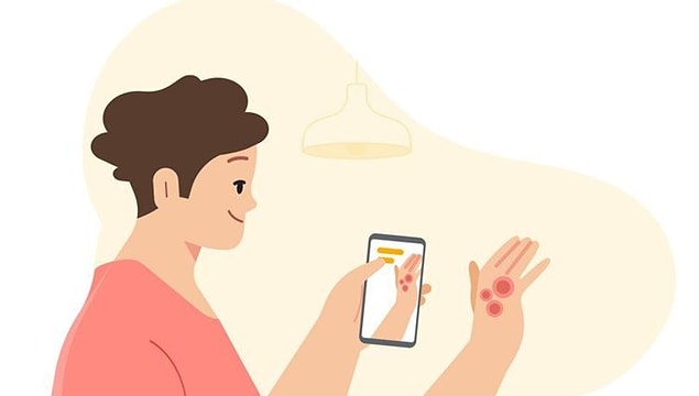 1. Sedef hastalığı bulaşıcıdır.