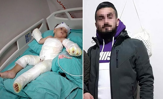 Cani Adam Eşini ve 1,5 Yaşındaki Oğlunu Kolonya Dökerek Yaktı