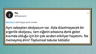 Toplum Baskısından Dolayı Memelerini Göstermemek İçin Skolyoz Olan Kadın Sosyal Medyanın Gündeminde