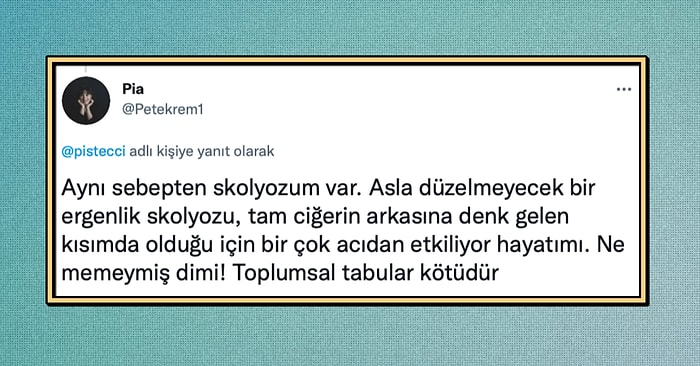 Toplum Baskısından Dolayı Memelerini Göstermemek İçin Skolyoz Olan Kadın Sosyal Medyanın Gündeminde