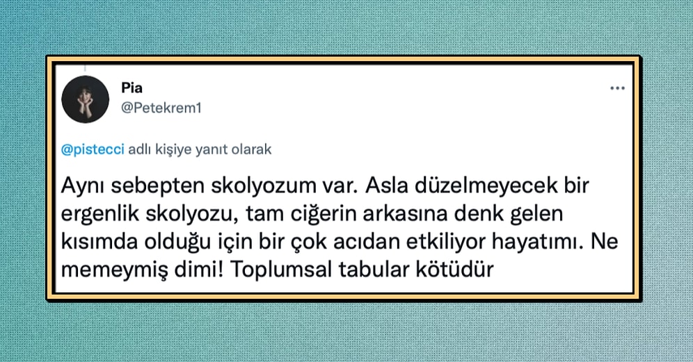 Toplum Baskısından Dolayı Memelerini Göstermemek İçin Skolyoz Olan Kadın Sosyal Medyanın Gündeminde