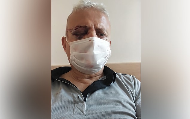 "Gözüm görmüyor, işimden de oldum"