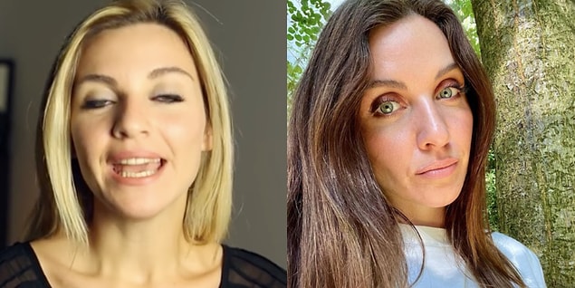 Merve Özkaynak'ın YouTube'da çektiği ilk videodaki hali ve şu anki hali arasında dağlar kadar fark var. Sanki epey gençleşmiş gibi görünüyor. Yüz hatlarında ufak değişimler var.