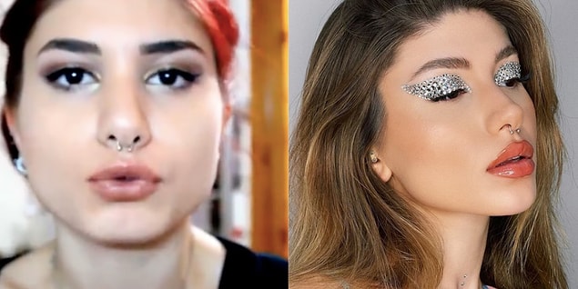 Şeyda Erdoğan'ın değişimini daha iyi görmeniz için son paylaştığı fotoğrafını sizlerle paylaştık. Genel olarak fark ettiyseniz kadınlar çene kısmında bir operasyon gerçekleştirmiş.