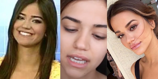 Selin Yağcıoğlu'nun da fenomen olmadan önceki hali ve sonrası epey farklı. Burnunda, gözünde, kaşında, dudaklarında ve çene kısımlarında dokunuşlar olduğunu görüyoruz.