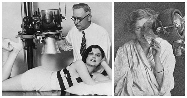 1900'lerde ise modern teknoloji sivilce tedavisinde yüzyılın buluşunu gerçekleştirmişti: Radyoaktif ışın terapisi!