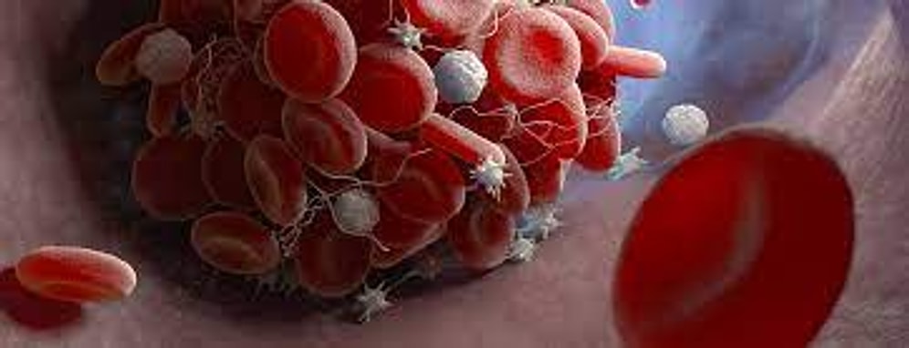 PLT: Platelets Nedir? Yüksekliği ve Düşüklüğü Ne Anlama Gelir? Değerleri Kaç Olmalıdır?