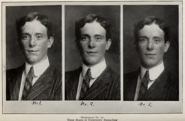 Удаление веснушек было возможным в те времена