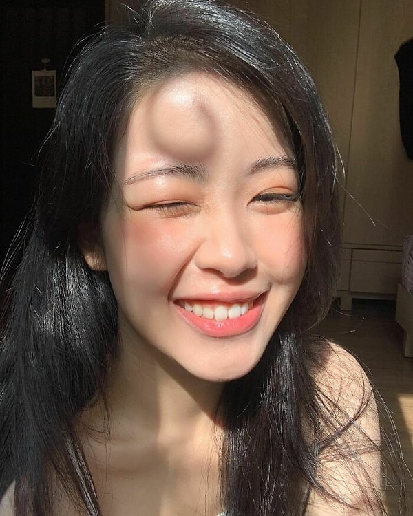 Тень от волос на лбу выглядит как шишка