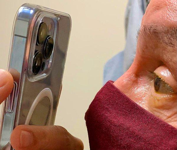 Tommy Korn isimli bir göz doktoru, satın aldığı iPhone 13 Pro Max'ın makro modu ile göz bozuklukları tanı ve tedavisi yapabileceğini düşündü.
