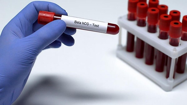 Beta HCG Değerleri Kaç Olmalıdır?