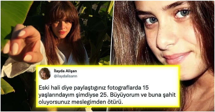 Son Zamanların Yükselen Oyuncularından İlayda Alişan, Estetik Yaptırdığı İddiasına Son Noktayı Koydu!