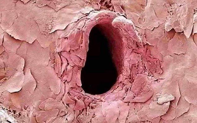 10. İğnenin vücudunuza girdiği anda açtığı deliğin bir elektron mikroskobu altındaki görüntüsü: