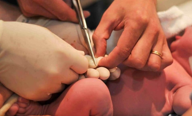 Göbek Kordonu Bakımında Dikkat edilmesi Gerekenler