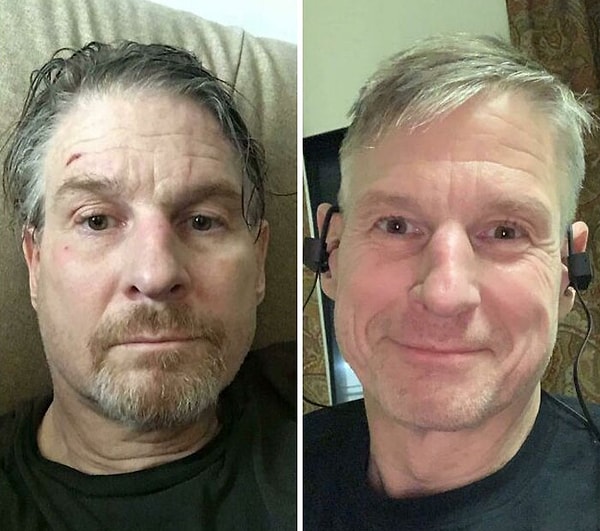 1. Год назад я был подавлен и склонен к самоубийству. Сегодня мне стало лучше