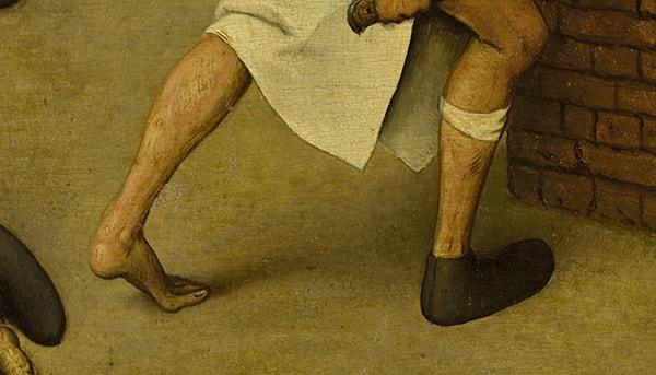 2. "Bir ayağında pabuç, diğeri çıplak" (Dengeli olmanın önemi)