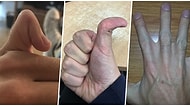 Vücutlarında Taşıdıkları Garip Farklılıklarla Herkesi Şaşırtan 15 Kişi