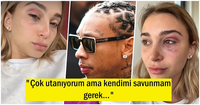 Eski Kız Arkadaşına Fiziksel Şiddet Uyguladığı İddia Edilen Tyga İçin Sabıka Kaydı Oluşturuldu!