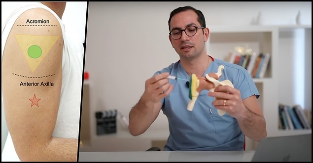 Peki iğne omuza nasıl yapılmalı? Öncelikle omuzun yukarısından parmağın inceliğine göre 2 ya da 3 parmak aşağısı tespit edilir ve iğne dik bir şekilde kola batırılır. Ve fotoğrafa dikkat ederseniz...