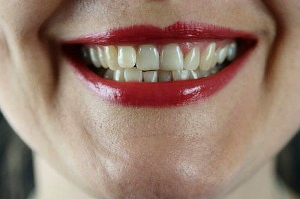 9. Çok daha sağlıklı dişlere sahip olacaksınız.