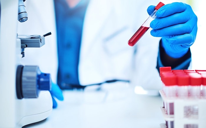 MCH Nedir? Yüksekliği ve Düşüklüğü Ne Anlamlara Gelir? Değerleri Kaç Olmalıdır?