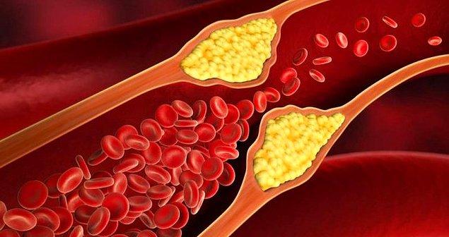 Toplam Kolesterol Testi Nedir?