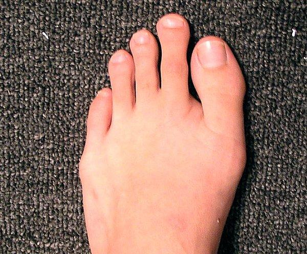 13. İkinci ayak parmağı baş parmağından uzun olan insanlar toplumun %10'unu oluşturuyor.